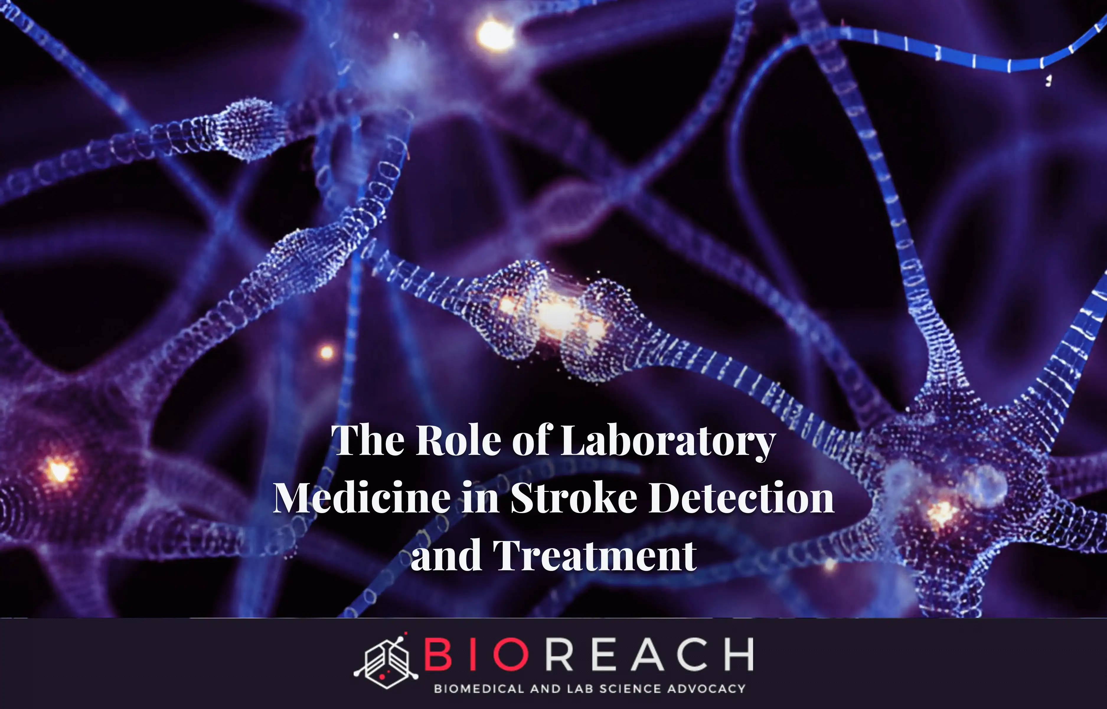 The Critical Role of Laboratory Medicine in Stroke Detection and Treatment