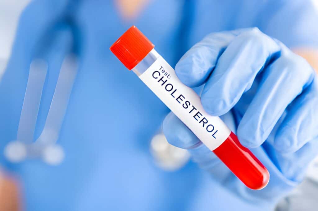 Common Lab Tests
