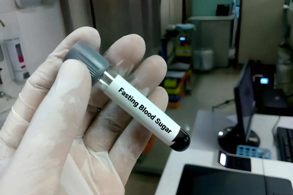 Preparing for Your Lab Test