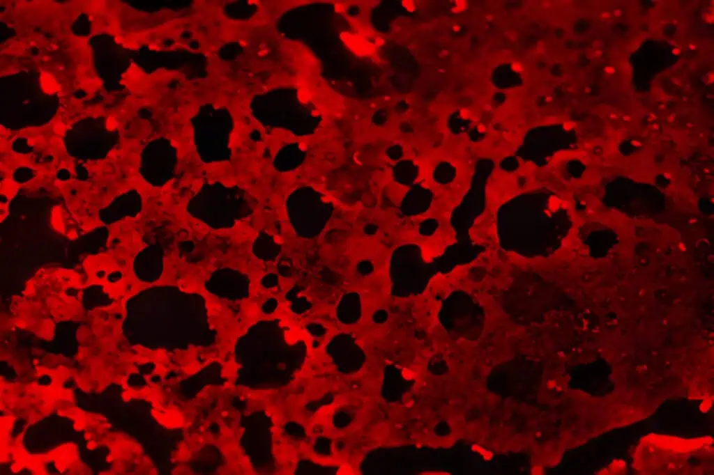 Live Blood Test Analysis