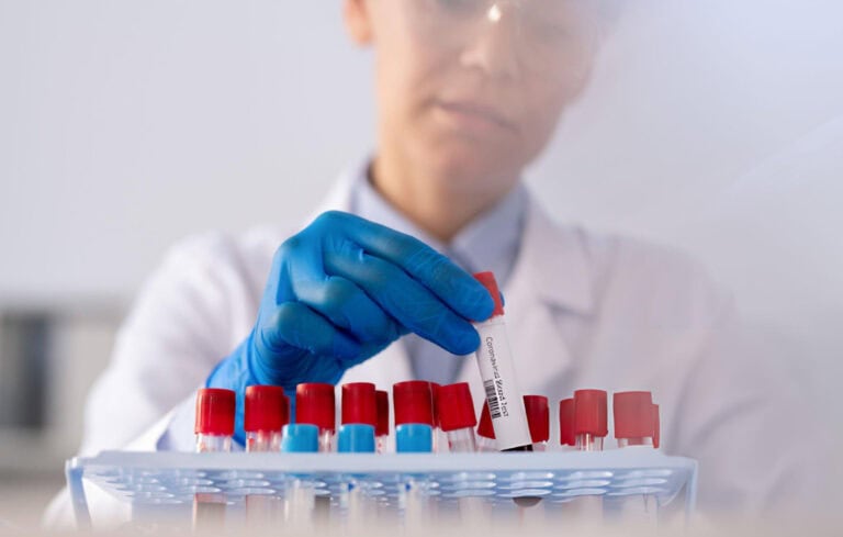 Blood Collection Capillary Explained: Step-by-Step Process and Best ...