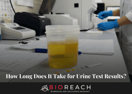 How Long Does It Take for Urine Test Results?