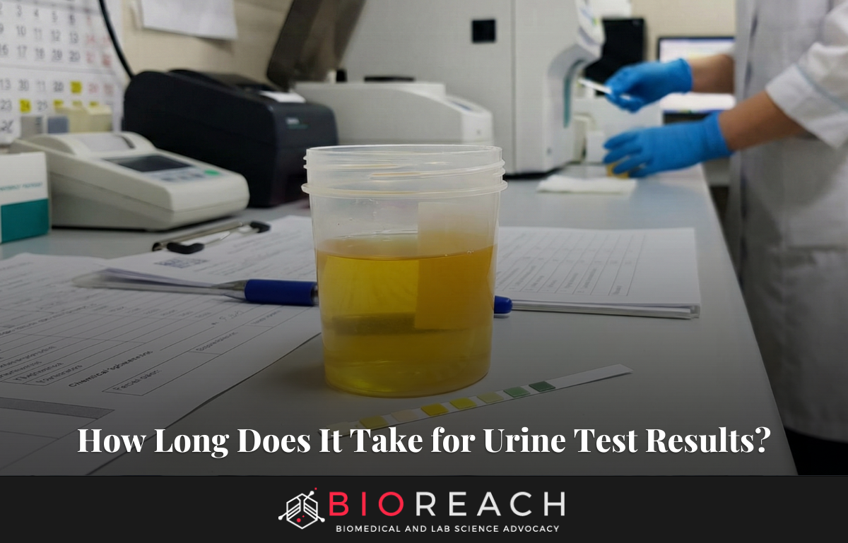 How Long Does It Take for Urine Test Results?