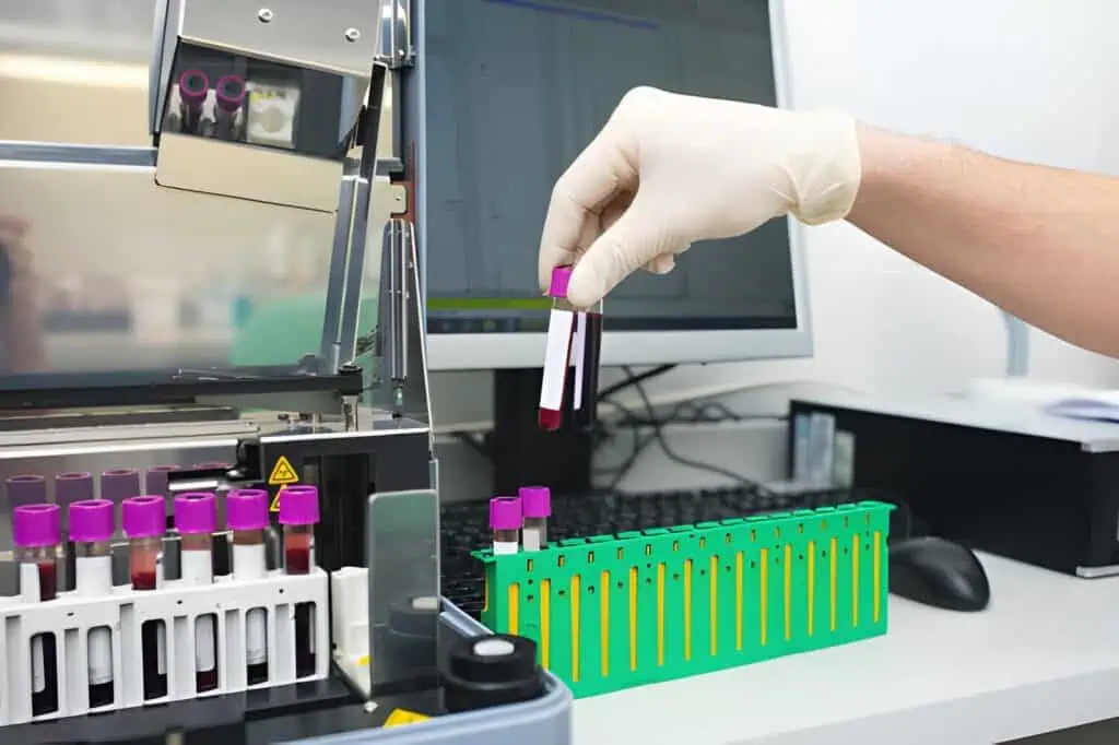 capillary blood collection tubes