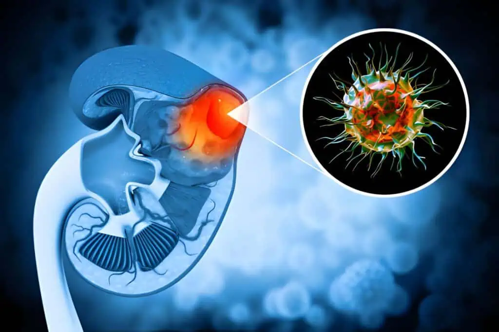 biomarkers in disease diagnosis