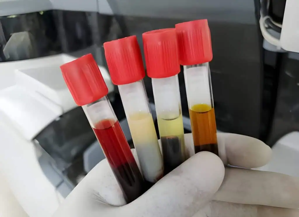 specimen rejection criteria in laboratories