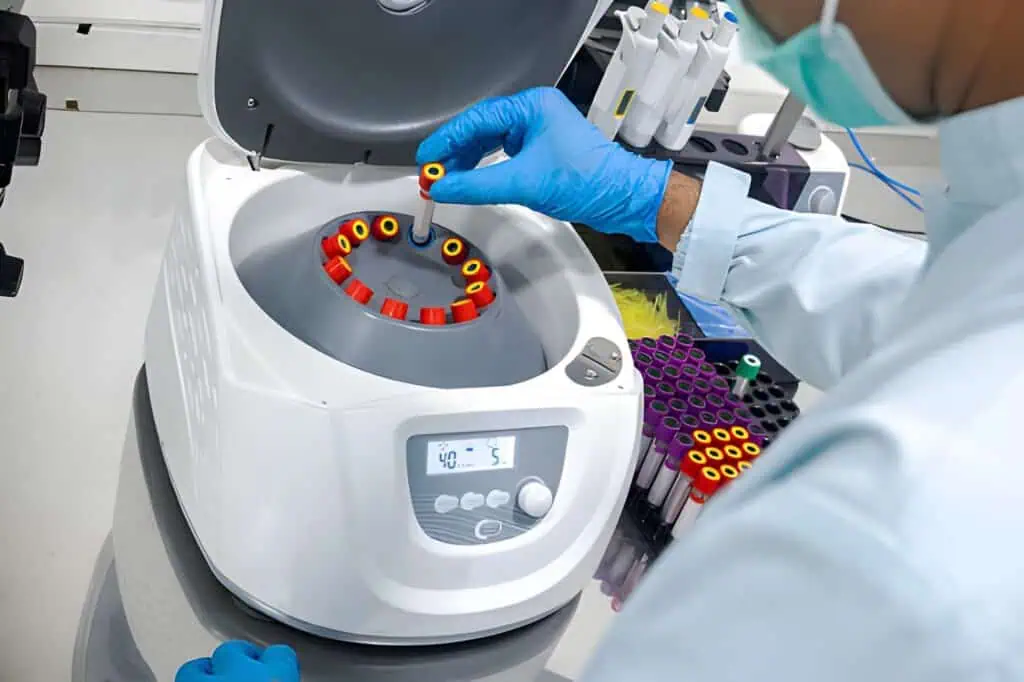 analytical phase in laboratory testing