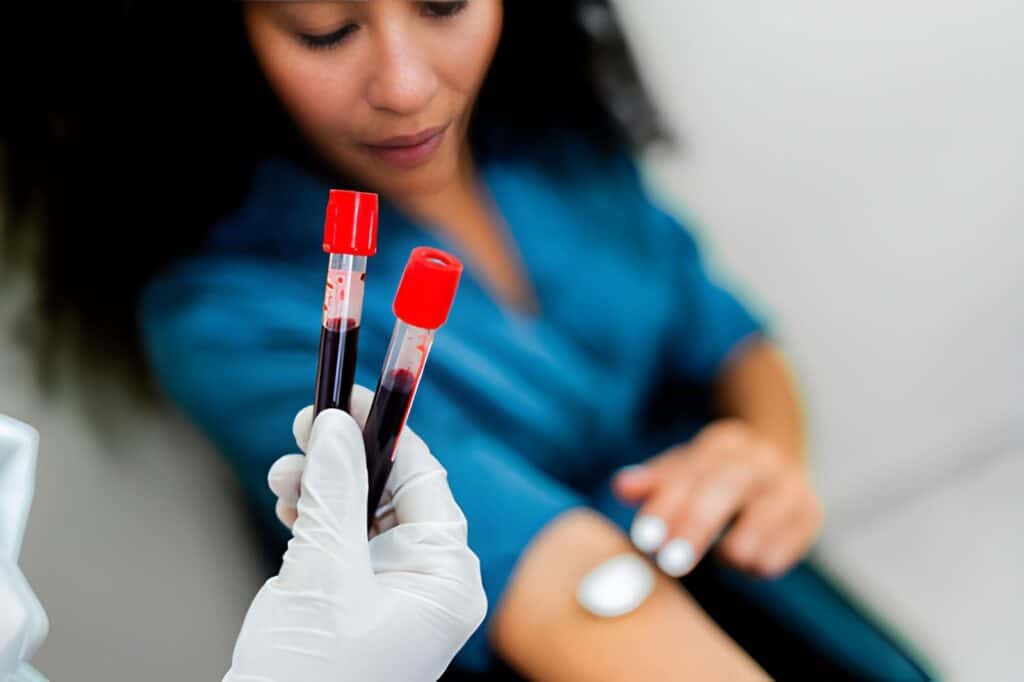 pre analytical phase in laboratory testing